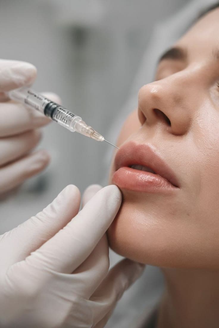 Lip Filler