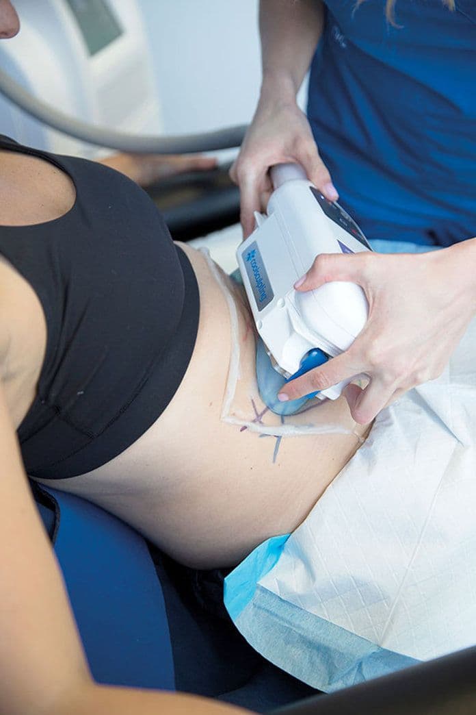 CoolSculpting